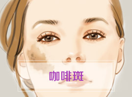 Ȱ