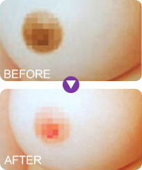 Ư