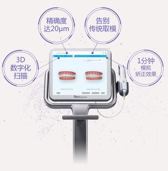 3d数字化扫描,精确到达20μm,告别传统取模,1分钟模拟矫正效果